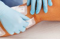 разширени вени лечение - 26534 бестселъри