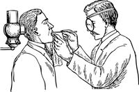 възпаление на венците - 63079 новини