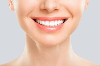 Invisalign - 90682 разновидности
