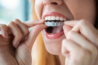 Invisalign - 35175 промоции