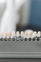 избелвания на зъби - 54563 вида | Deckoff Dental избелвания на зъби - 51337 вида