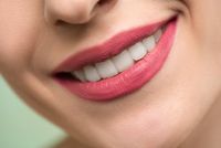 избелвания на зъби - 95732 типа избелвания на зъби - 27179 типа