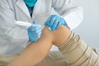 мезенхимни стволови клетки - 22726 отстъпки | Bioregeneration мезенхимни стволови клетки - 84055 отстъпки