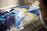 мезенхимни стволови клетки - 22199 постижения | Bioregeneration мезенхимни стволови клетки - 68679 постижения