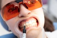 циркониеви коронки - 27247 награди циркониеви коронки - 80381 награди