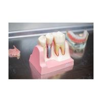 почистване на зъбен камък Варна - 54379 новини | Dental Club почистване на зъбен камък Варна - 33241 новини