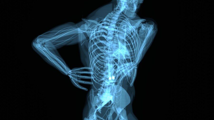 болки в тазобедрената става - 58572 бестселъри | osteostrong.bg болки в тазобедрената става - 84716 бестселъри