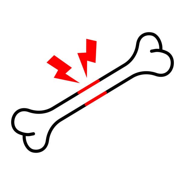 костна плътност - 77825 разновидности костна плътност - 46070 разновидности